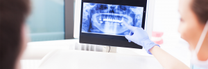 reviewing a dental digital-x-ray