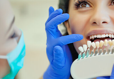 Cosmetic-dentistry-tooth-matching